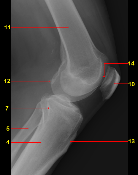 File:Normal radiographic anatomy of the knee (Radiopaedia 42948-46192 Lateral 1).jpg