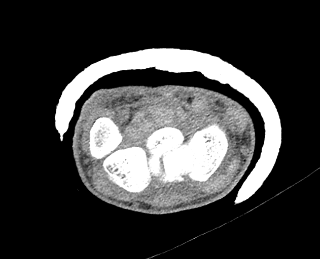 Normal wrist CT (Radiopaedia 41425-44297 Axial non-contrast 31).png