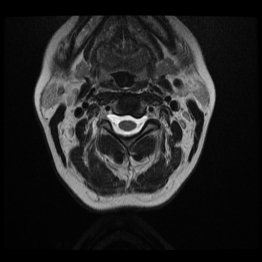 File:Normal cervical and thoracic spine MRI (Radiopaedia 35630-37156 Axial T2 26).png