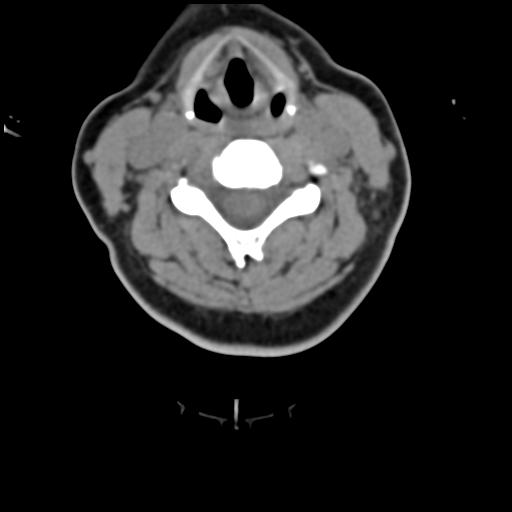 File:Normal cervical spine MRI (including Dixon) (Radiopaedia 42762-45926 C 1).png