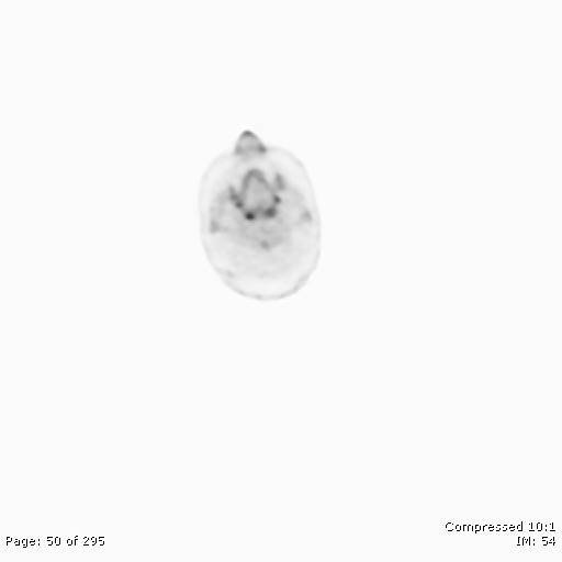File:Normal F-18 FDG PET-CT (Radiopaedia 77382-89510 C 50).jpg