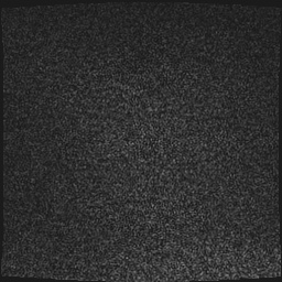 Cavernous sinus meningioma (Radiopaedia 63682-72367 Sagittal T1 C+ 1).jpg