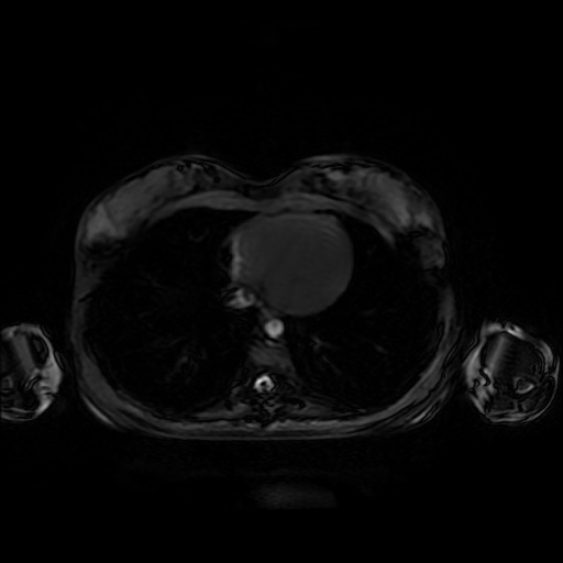 File:Normal MRI abdomen in pregnancy (Radiopaedia 88001-104541 D 3).jpg