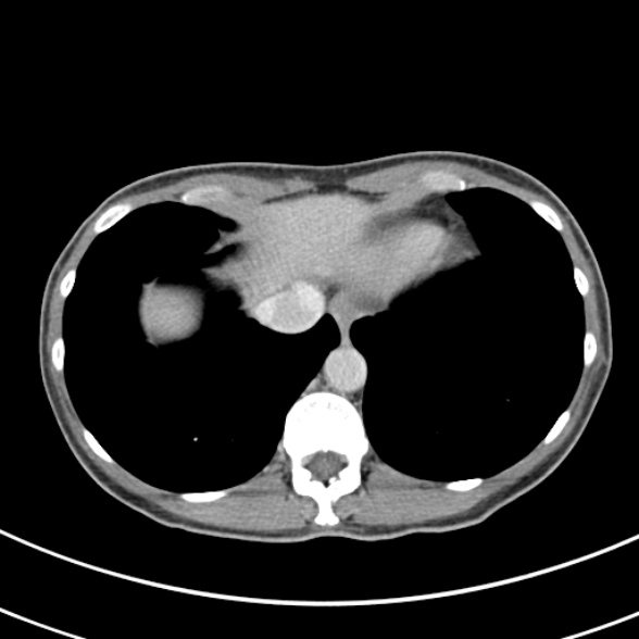 File:Normal multiphase CT liver (Radiopaedia 38026-39996 C 4).jpg
