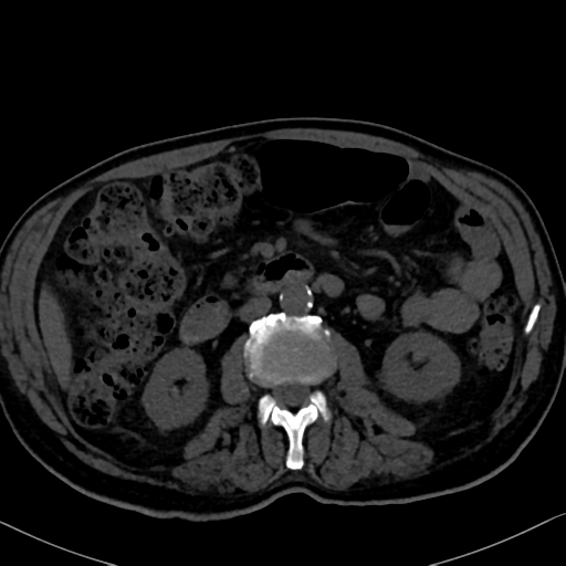 File:Normal CT intravenous cholangiogram (Radiopaedia 38199-40208 Axial IVC 55).png