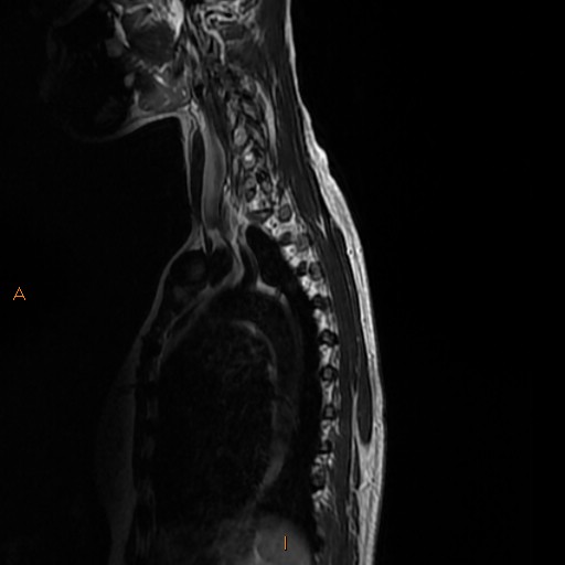 File:Normal spine MRI (Radiopaedia 77323-89408 E 13).jpg