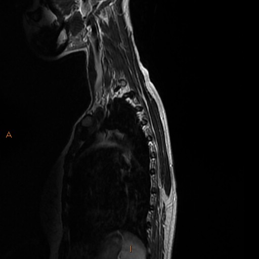File:Normal spine MRI (Radiopaedia 77323-89408 E 15).jpg