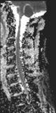 File:Normal MRI cervical spine (infection protocol) (Radiopaedia 53916-60039 Sagittal 5).png