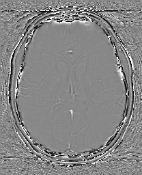 Cerebral cavernous venous malformation (Radiopaedia 70008-80021 G 42).jpg