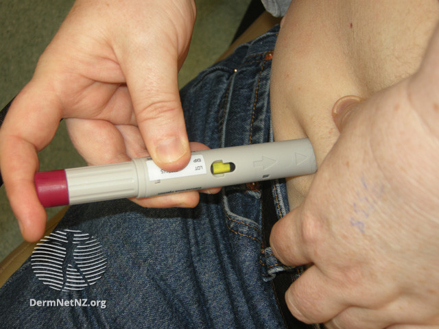 File:Giving the subcutaneous injection (DermNet NZ treatments-adalimumab11).jpg