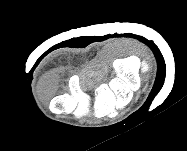 Normal wrist CT (Radiopaedia 41425-44297 Axial non-contrast 24).png