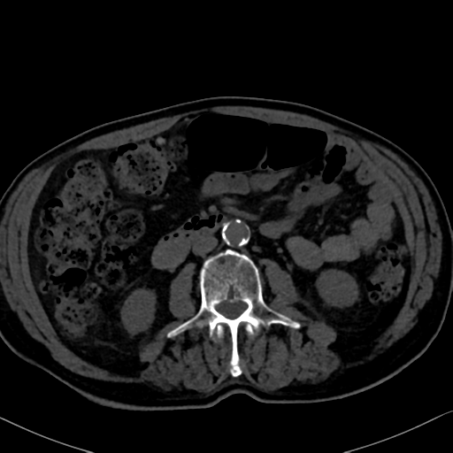 File:Normal CT intravenous cholangiogram (Radiopaedia 38199-40208 Axial IVC 60).png
