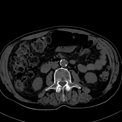 File:Normal CT intravenous cholangiogram (Radiopaedia 38199-40208 Axial IVC 59).png