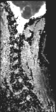 File:Normal MRI cervical spine (infection protocol) (Radiopaedia 53916-60039 Sagittal 10).png