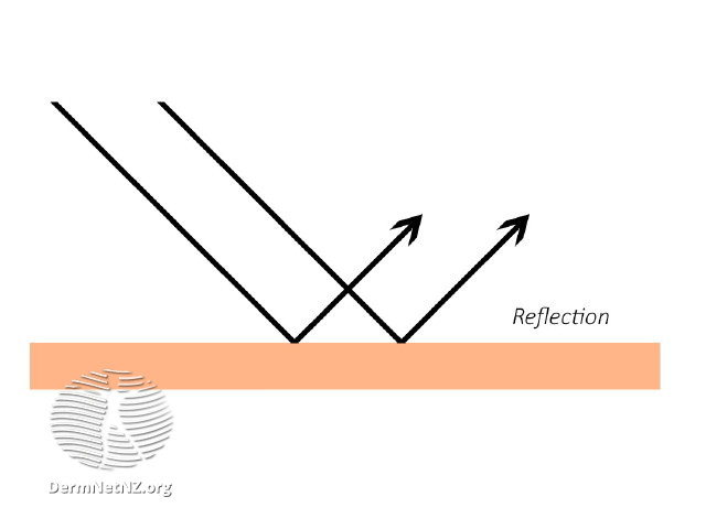 File:Reflection of light (DermNet NZ reflection).jpg
