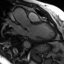 File:Cardiac MRI- standard imaging planes (Radiopaedia 14225-14090 C 2).jpg