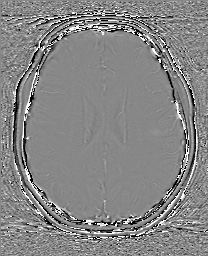 Cerebral cavernous venous malformation (Radiopaedia 70008-80021 G 47).jpg