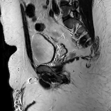 File:Normal prostate (MRI) (Radiopaedia 29986-30535 Sagittal T2 16).jpg