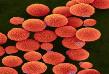 SEM image of encapsulated pathogenic Cryptococcus neoformans yeast