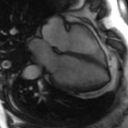 File:Cardiac MRI- standard imaging planes (Radiopaedia 14225-14090 B 4).jpg