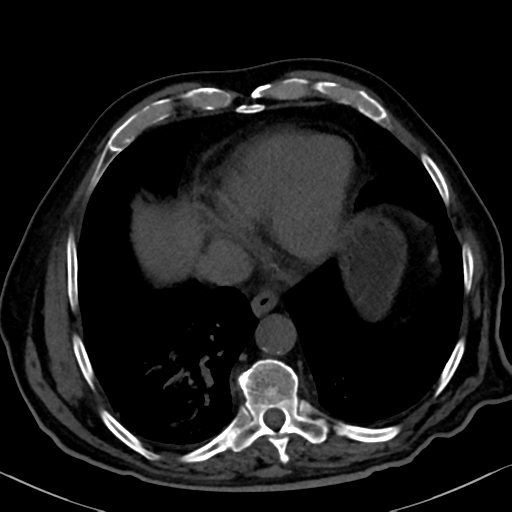 File:Normal CT intravenous cholangiogram (Radiopaedia 38199-40208 Axial IVC 10).png