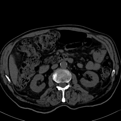 File:Normal CT intravenous cholangiogram (Radiopaedia 38199-40208 Axial IVC 52).png