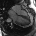 File:Cardiac MRI- standard imaging planes (Radiopaedia 14225-14090 B 10).jpg