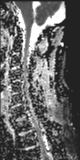 File:Normal MRI cervical spine (infection protocol) (Radiopaedia 53916-60039 Sagittal 8).png