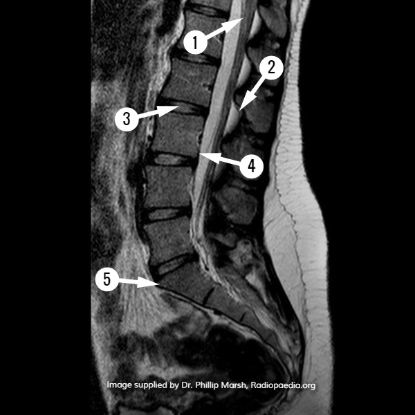 File:MRI spine - sagittal (anatomy quiz) (Radiopaedia 60879).jpg