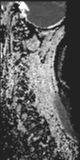 File:Normal MRI cervical spine (infection protocol) (Radiopaedia 53916-60039 Sagittal 14).png