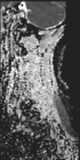 File:Normal MRI cervical spine (infection protocol) (Radiopaedia 53916-60039 Sagittal 15).png