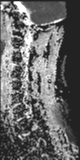 File:Normal MRI cervical spine (infection protocol) (Radiopaedia 53916-60039 Sagittal 3).png