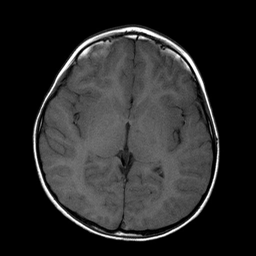 File:Brainstem ganglioglioma (Radiopaedia 10763-11224 Axial T1 10).jpg