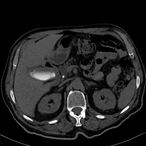 File:Normal CT intravenous cholangiogram (Radiopaedia 38199-40208 Axial IVC 37).png