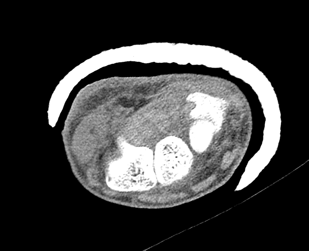 Normal wrist CT (Radiopaedia 41425-44297 Axial non-contrast 27).png