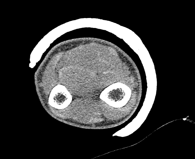 Normal wrist CT (Radiopaedia 41425-44297 Axial non-contrast 54).png