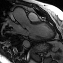 File:Cardiac MRI- standard imaging planes (Radiopaedia 14225-14090 C 3).jpg