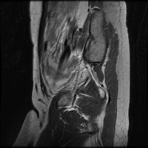 File:Normal female pelvis MRI (retroverted uterus) (Radiopaedia 61832-69933 Sagittal T2 6).jpg