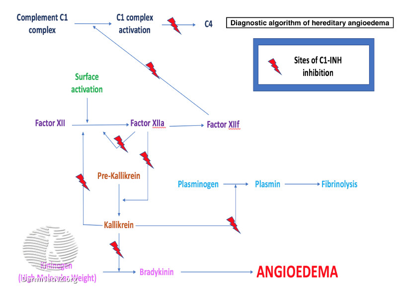File:Sites of C1-esterase inhibition (DermNet NZ Hereditary-angioedema-Figure-3).jpg