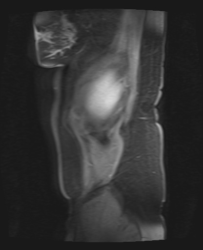 File:Normal hepatobiliary phase liver MRI (Radiopaedia 58968-66230 C 4).jpg