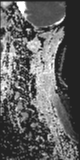 File:Normal MRI cervical spine (infection protocol) (Radiopaedia 53916-60039 Sagittal 13).png