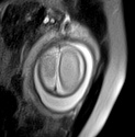 File:Normal brain fetal MRI - 22 weeks (Radiopaedia 50623-56050 Axial T2 Haste 2).jpg