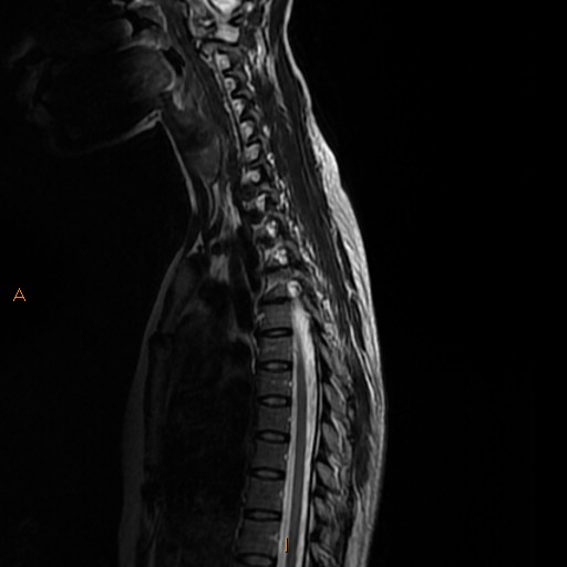 File:Normal spine MRI (Radiopaedia 77323-89408 E 5).jpg