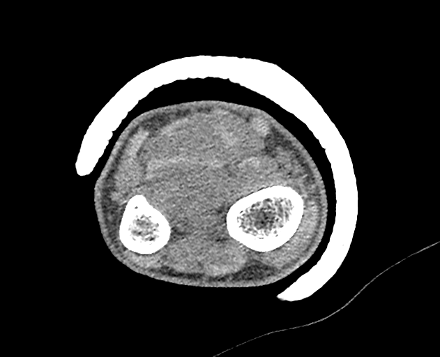 Normal wrist CT (Radiopaedia 41425-44297 Axial non-contrast 47).png