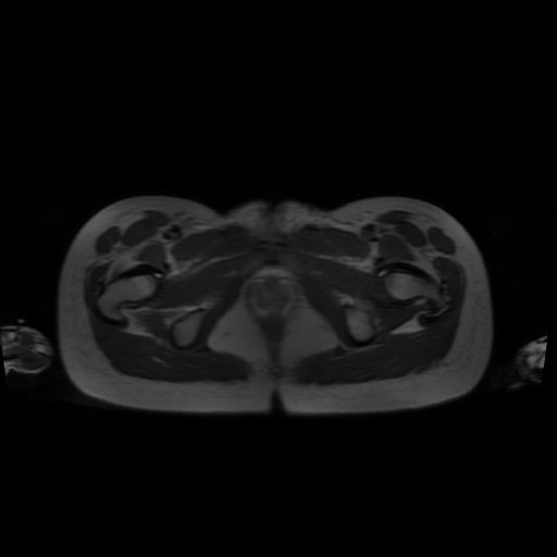 File:Normal MRI abdomen in pregnancy (Radiopaedia 88001-104541 Axial T2 73).jpg
