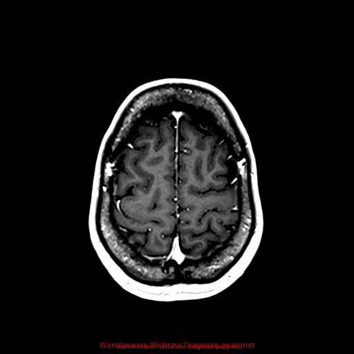 Normal adult brain MRI (non-enhanced and contrast-enhanced) (Radiopaedia 75262-86379 Axial T1 C+ 152).jpg