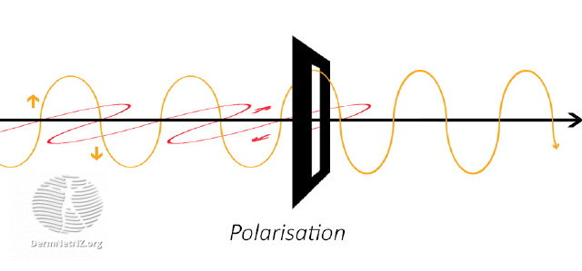 File:Polarisation of light (DermNet NZ polarisation).jpg