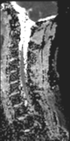 File:Normal MRI cervical spine (infection protocol) (Radiopaedia 53916-60039 Sagittal 4).png