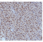 File:PMC4941322 oncotarget-07-16384-g001 (1).png