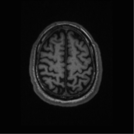 File:Alzheimer disease - probable (Radiopaedia 35334-36837 Axial T1 60).png